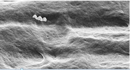 New technique to improve the success rate of root canal treatments