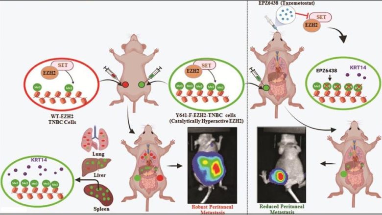 Researchers find novel way to target Triple-Negative Breast Cancer